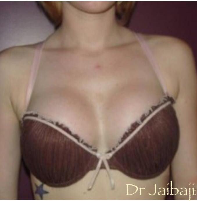 Jaibaji Plastic Surgery Photo