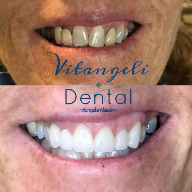 Images Vitangeli Dental