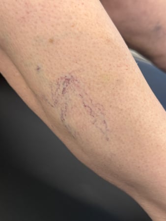 Images Help My Veins