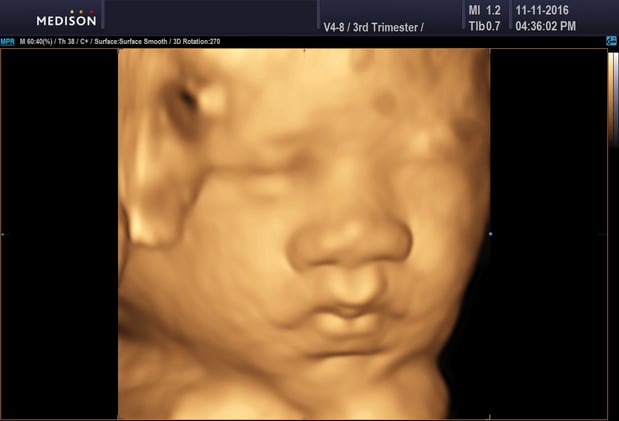 Images Heavenly 3D 4D Ultrasounds