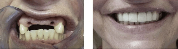 Images Allen Dentistry