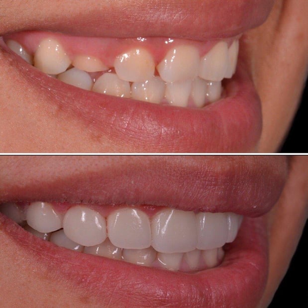 Images Carson Dental & Cosmetic Centre