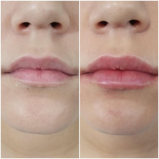 Images Gray Dermatology & Cosmetic Surgery