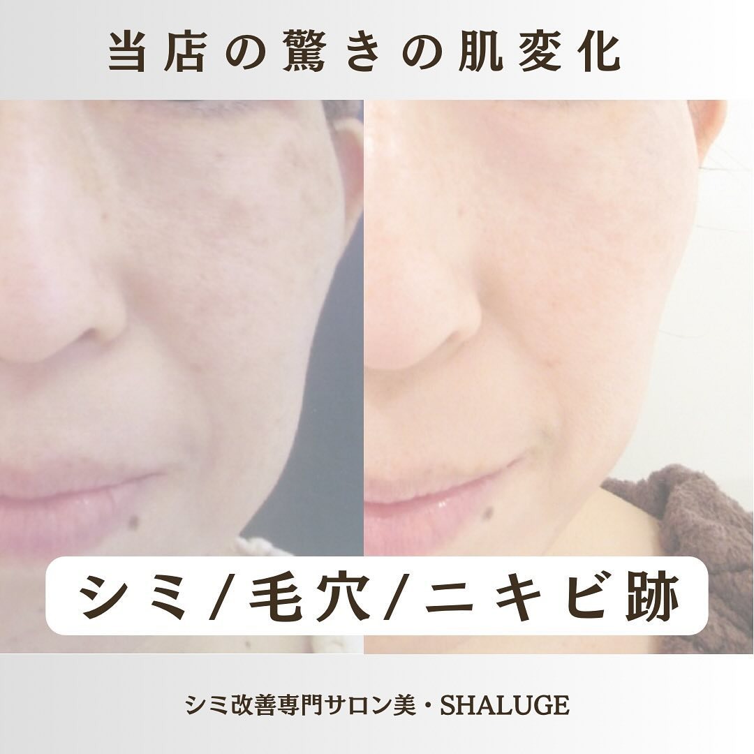 Images 美・SHALUGE