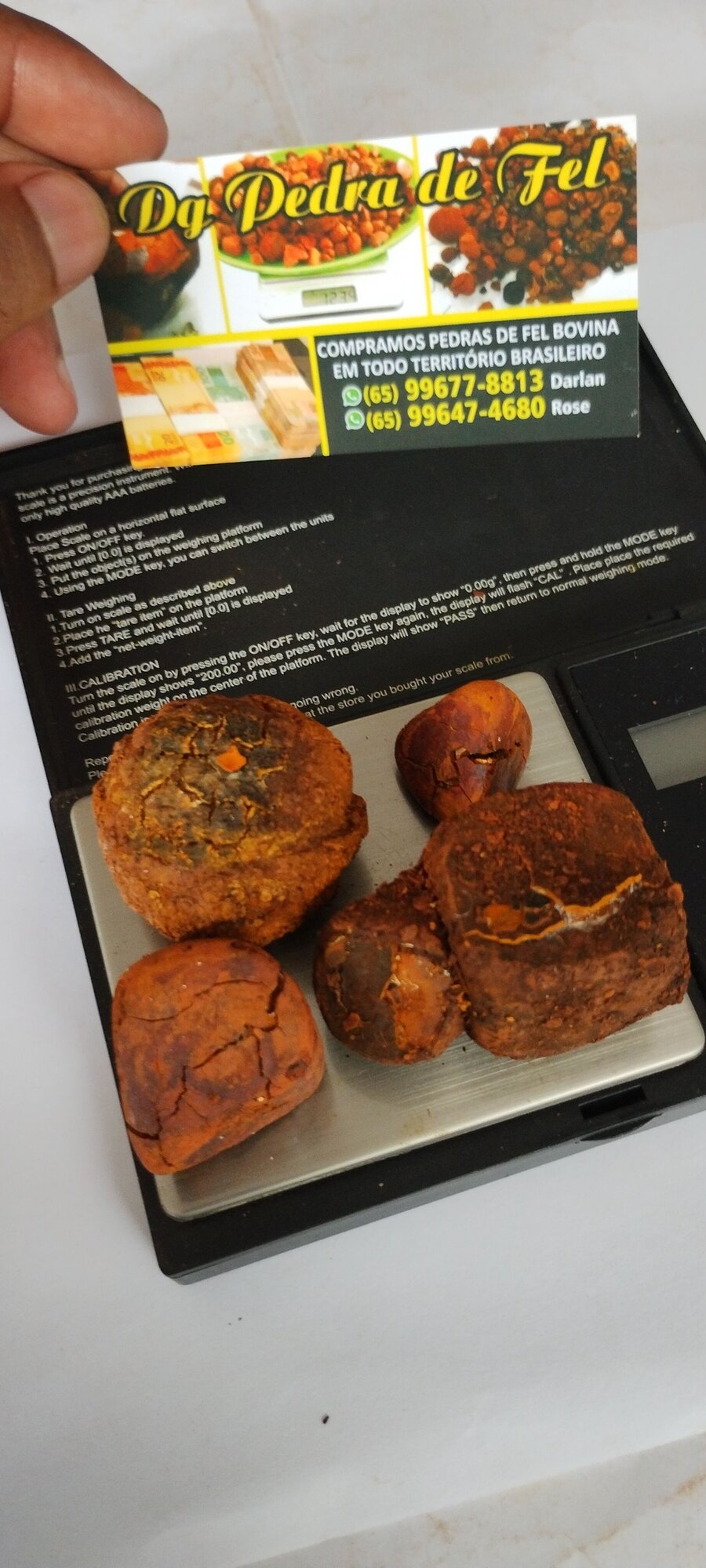 Images Dg pedras de fel bovinos