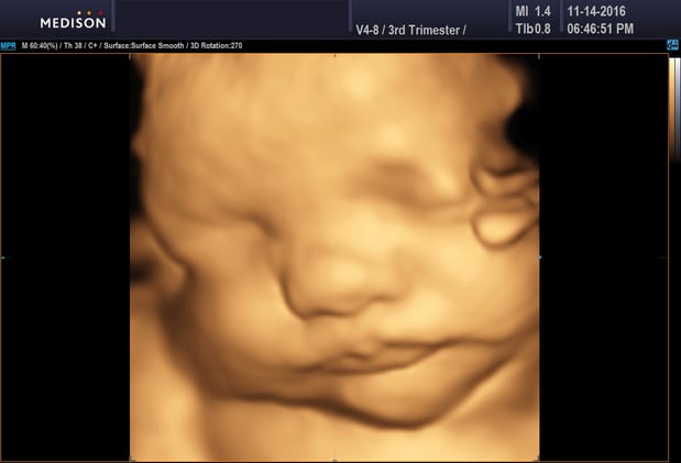 Images Heavenly 3D 4D Ultrasounds