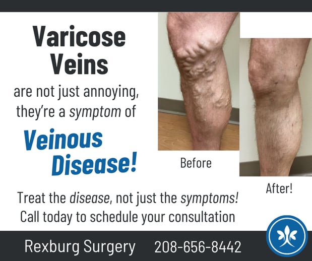 Images Rexburg Surgery