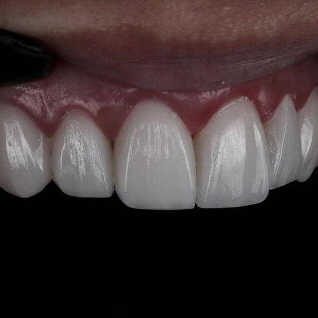 Images Gables iSmile