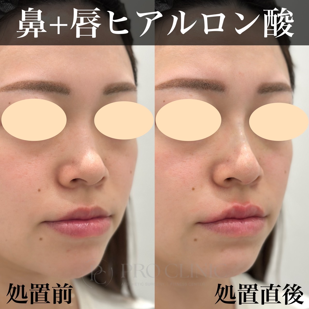 Images プロクリニック