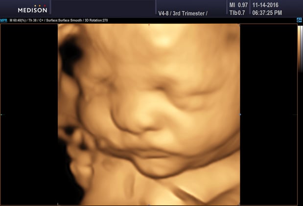 Images Heavenly 3D 4D Ultrasounds