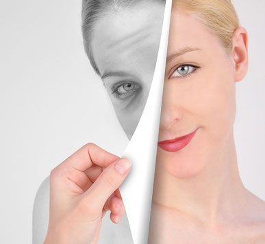 Durch die Mesotherapie lassen sich kleine Schönheitsfehler sowie das Hautbild beeinflussen, ohne operativen Eingriff.