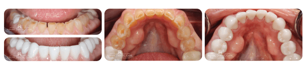 Images Aspire Dental Care PLLC