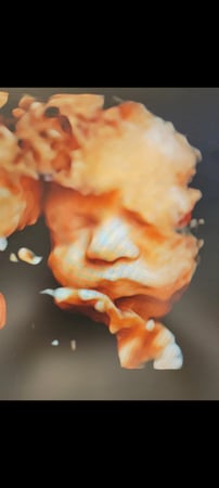 Images Love At First Sight 3D/4D Ultrasound Imaging Studio, LLC