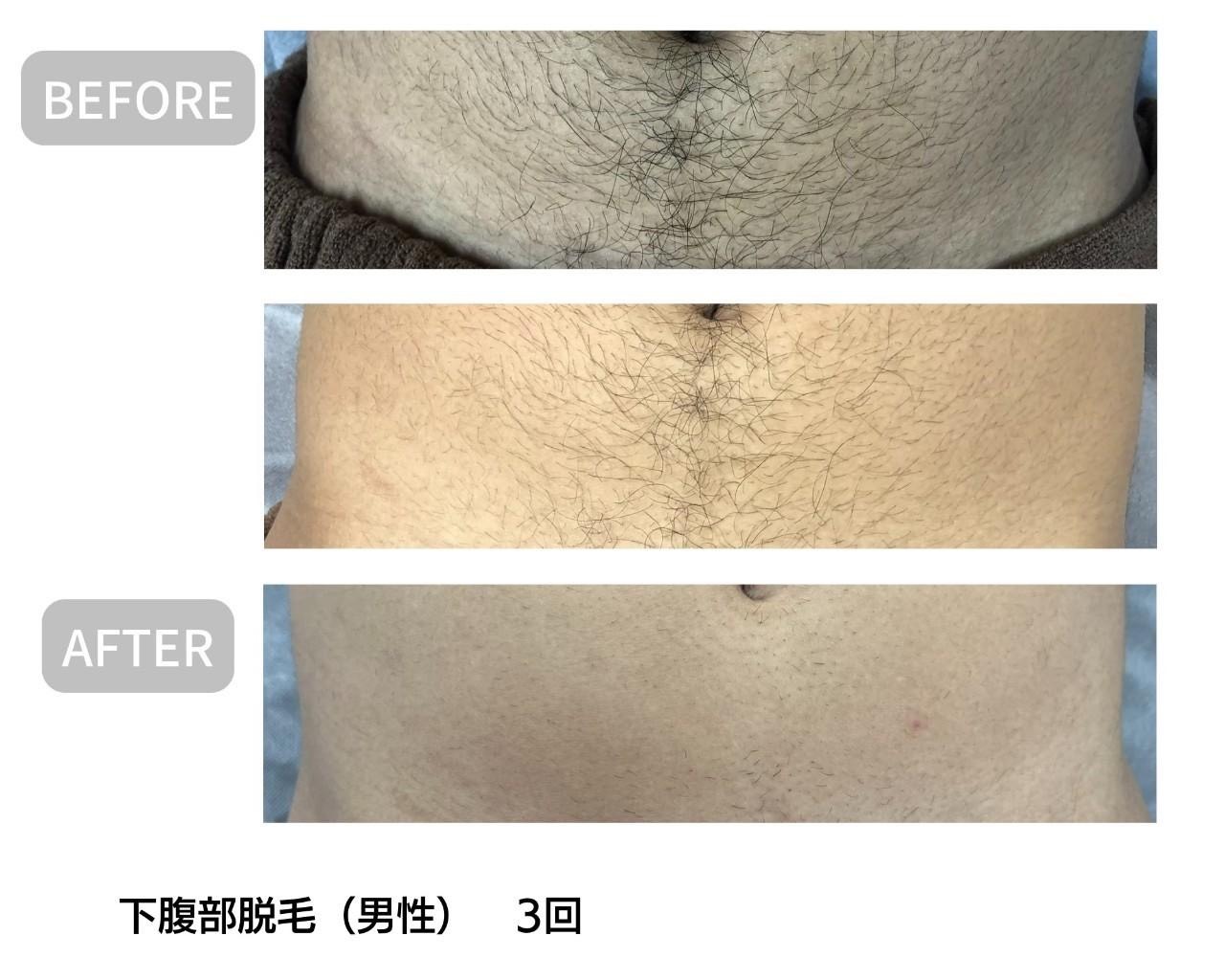 Images Private Salon BB