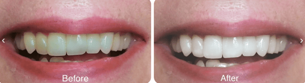 Images Northpointe Smiles