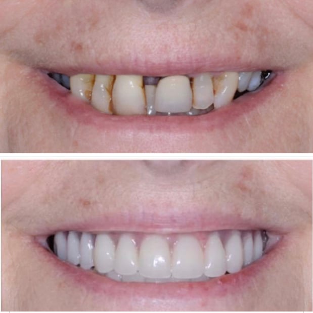 Images Preserve Family Dentistry