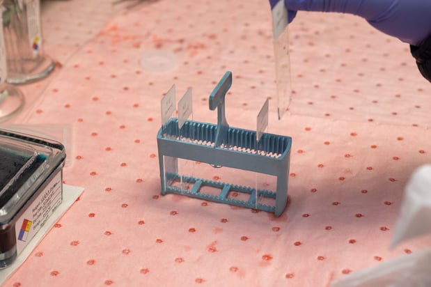 Images Golden State Dermatopathology Lab