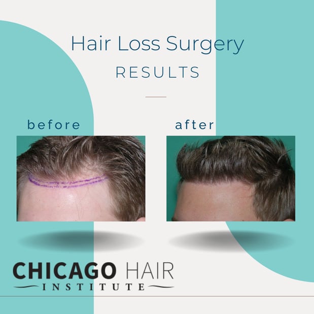 Images Chicago Hair Institute