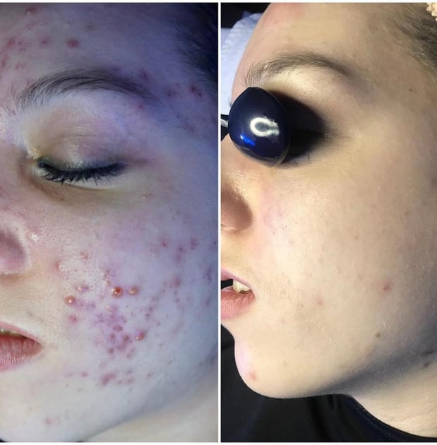 Images Face of Jules