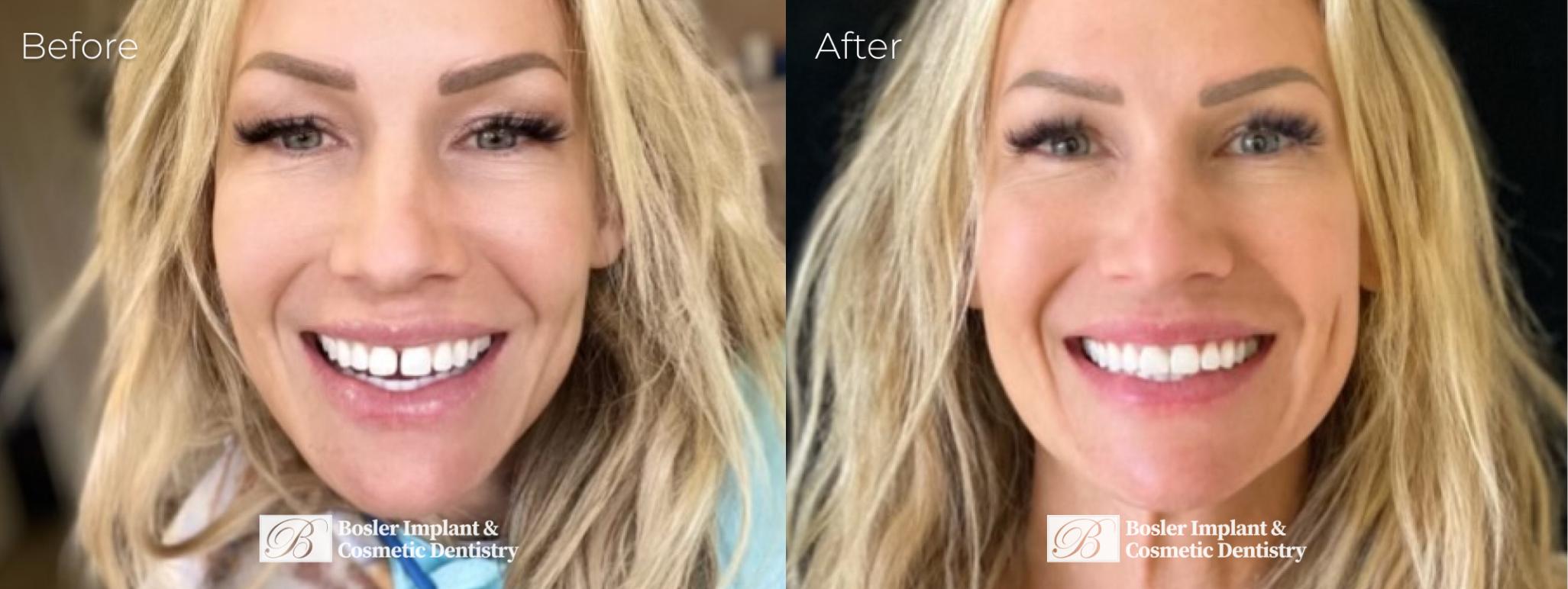 Bosler Implant & Cosmetic Dentistry Image