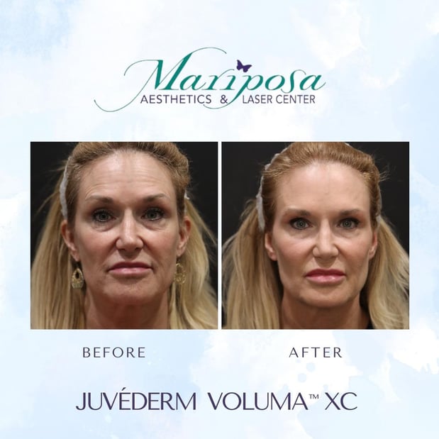 Images Mariposa Aesthetics & Laser Center