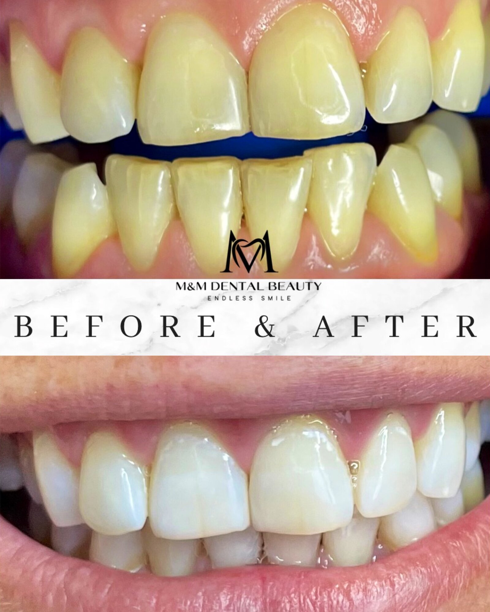 M&M Dental Beauty, Eichendorffstraße 70 in Pfullingen