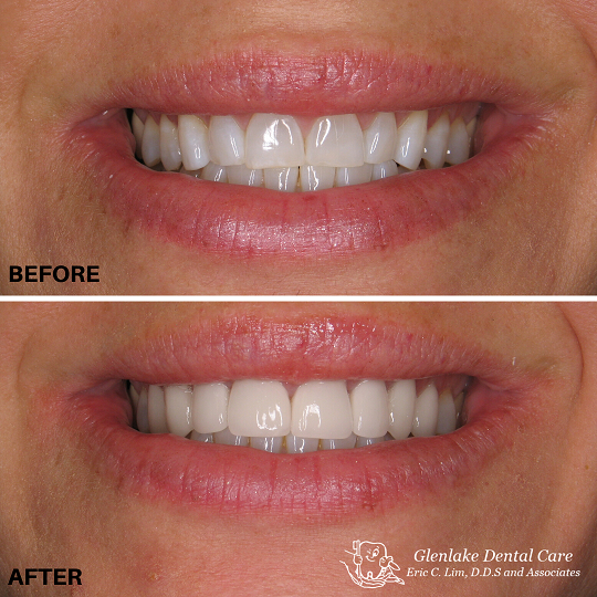 Images Glenlake Dental Care