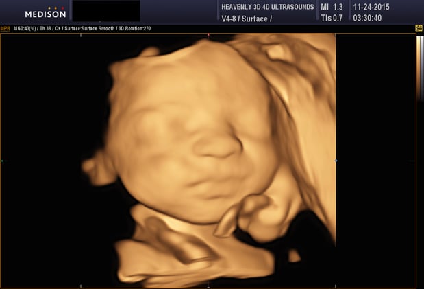 Images Heavenly 3D 4D Ultrasounds-Upland
