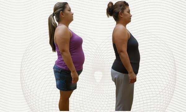 Images TrimBody M.D.