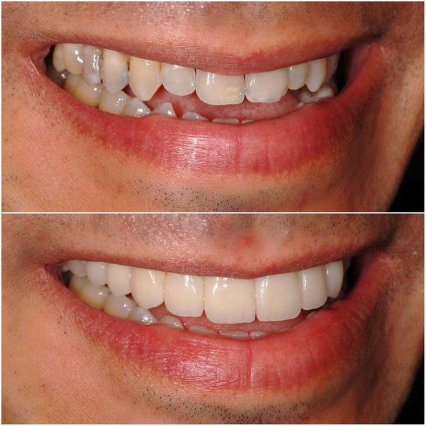Images Pacific Dental Care