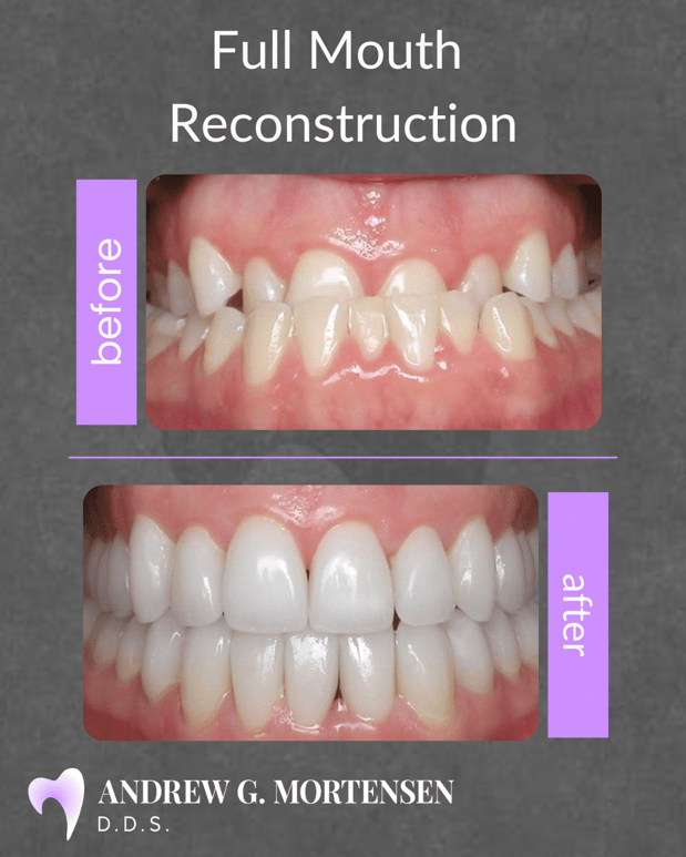 Images Andrew G. Mortensen, DDS