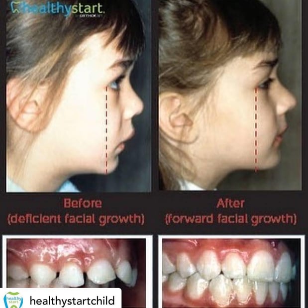Images Lifetime Dental & Fastbraces