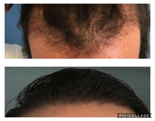 Images Dr. George Brennan - Cosmetic Surgeon Newport Beach