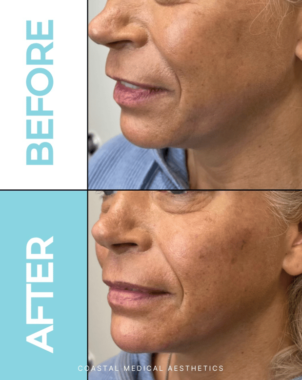 Images Coastal Medical Aesthetics