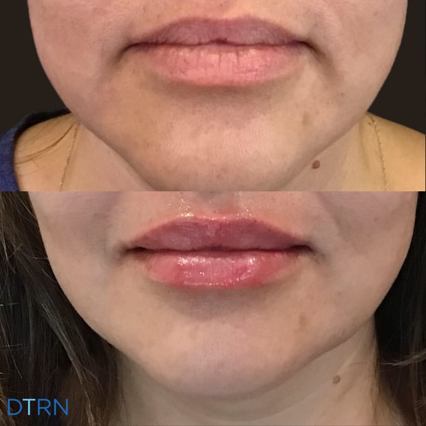 Images DermaTouch RN