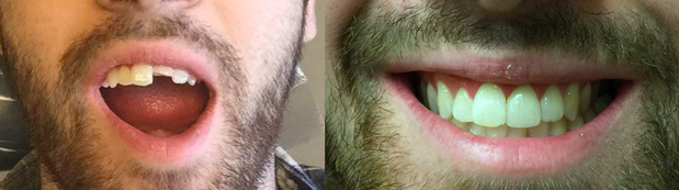 Images Cosmetic and Implant Dentistry of Connecticut