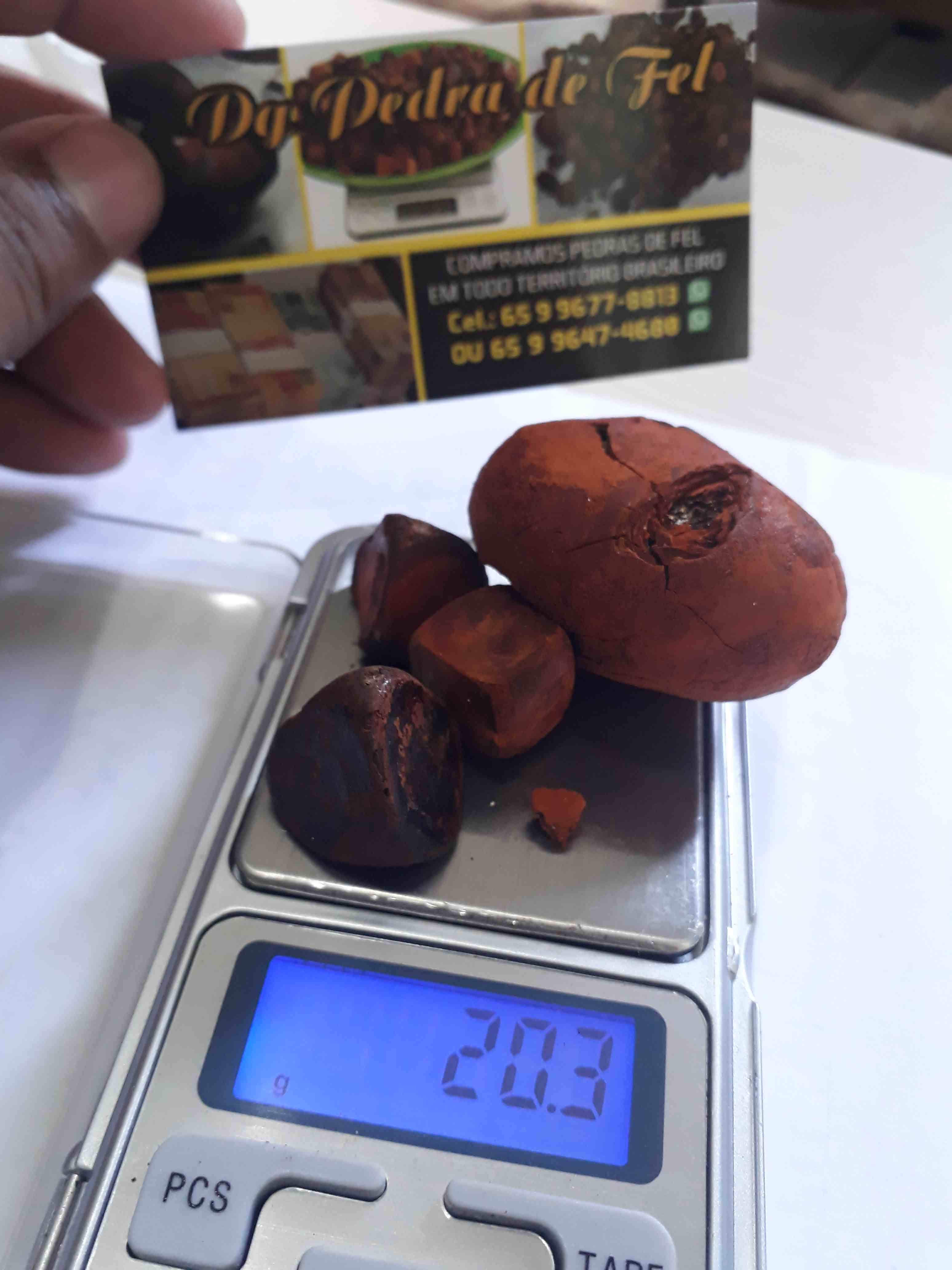 Images Dg pedras de fel bovinos