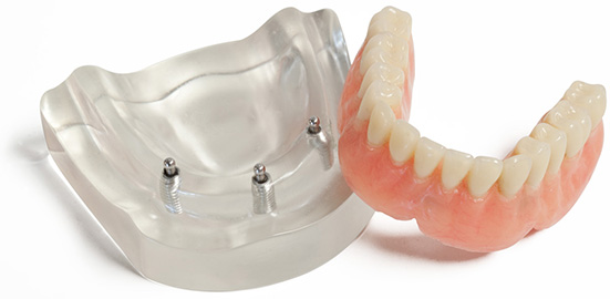 Images Centre Dentaire Georges - Invisalign, Dentiste Lasalle