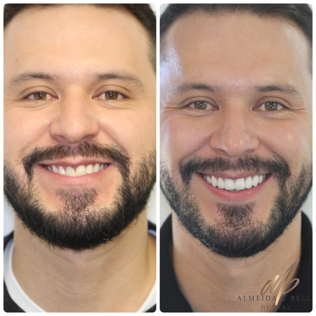 Images Almeida & Bell Dental Lone Tree - General, Cosmetic, and Implant Dentistry