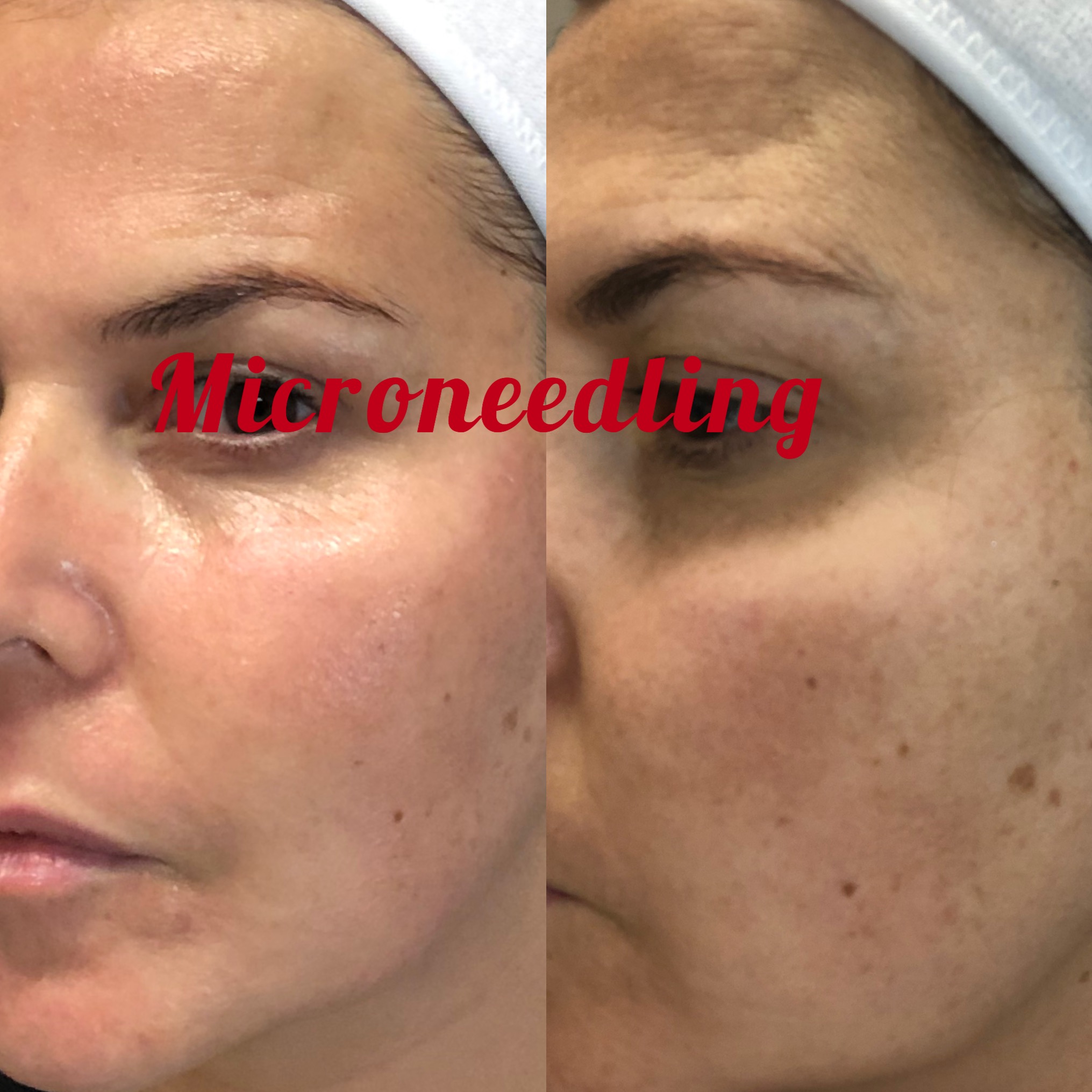 Images Clinique d'Esthétique Leila - Hydrafacial, Microblading, Épilation Laser Sainte-Foy