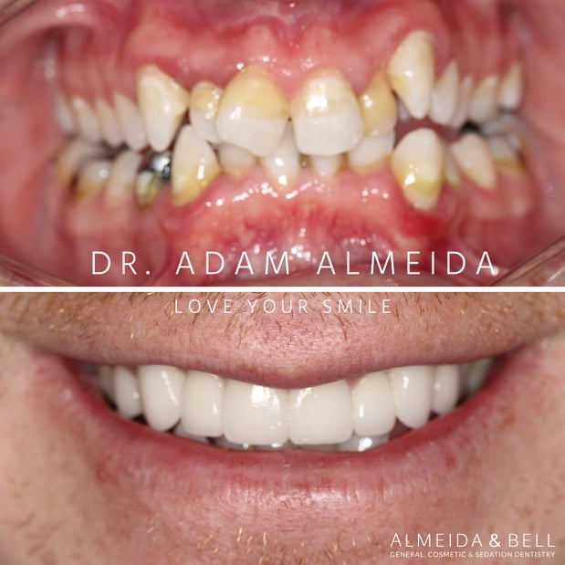 Images Almeida & Bell Dental Lone Tree - General, Cosmetic, and Implant Dentistry