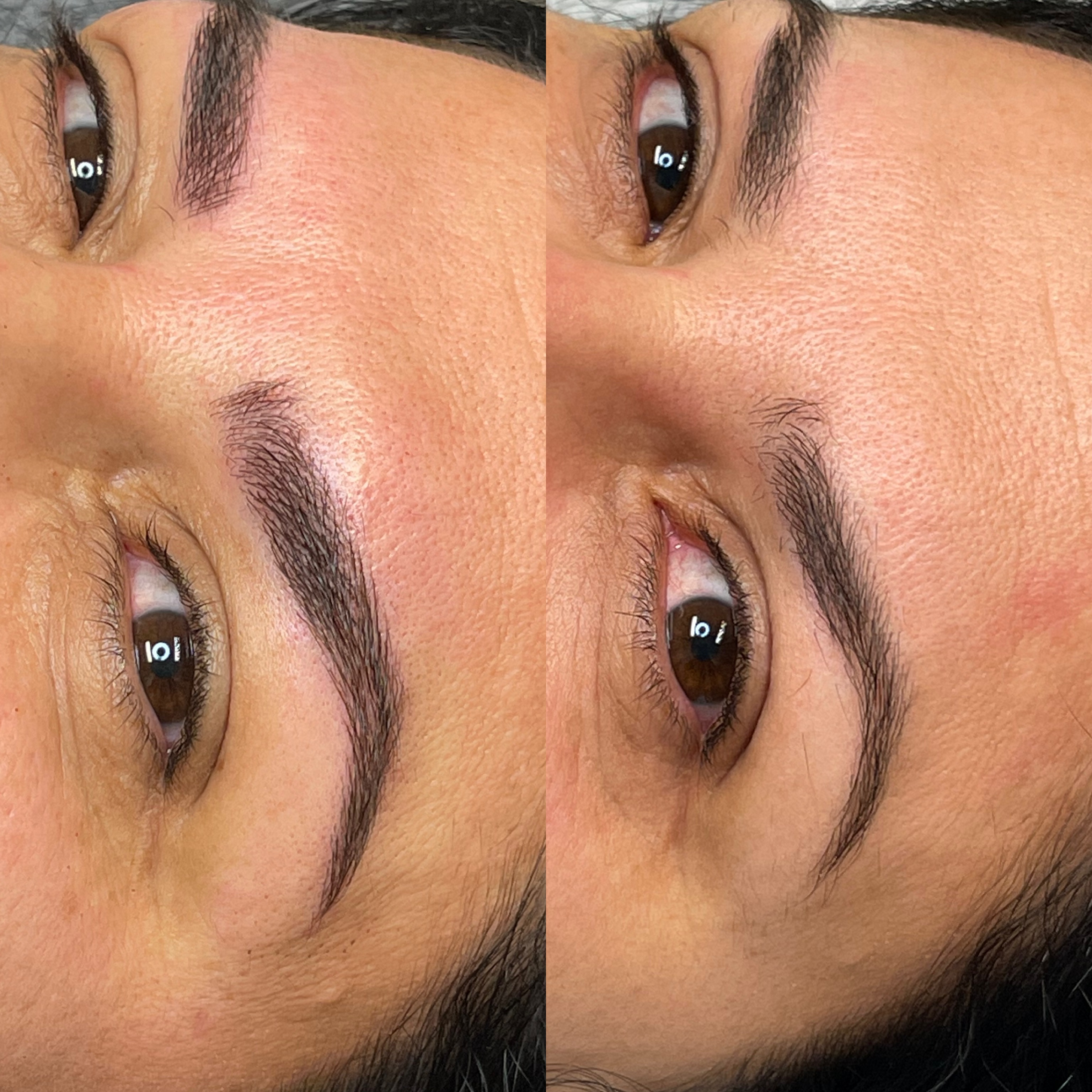 Images Clinique d'Esthétique Leila - Hydrafacial, Microblading, Épilation Laser Sainte-Foy