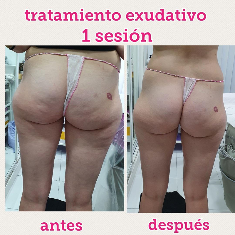 Images Centro De Estética Avanzada Y Láser Verónica Vico