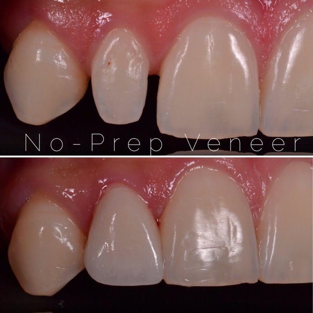 Images Carson Dental & Cosmetic Centre