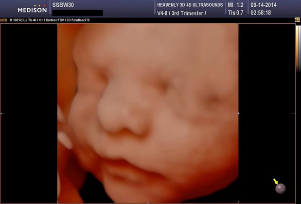 Images Heavenly 3D 4D Ultrasounds-Upland