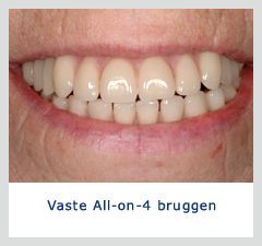 Foto's Kliniek voor Cosmetische Tandheelkunde Amsterdam Zuid