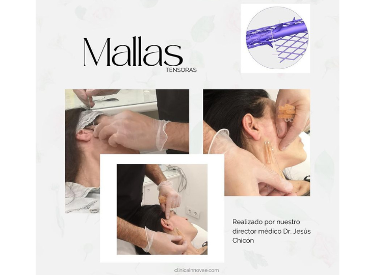 Images Clínica Innovae Medicina Estética