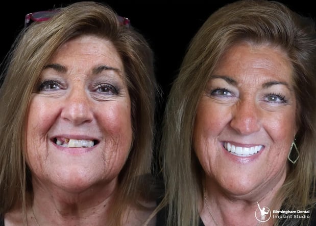 Images Birmingham Dental Implant Studio