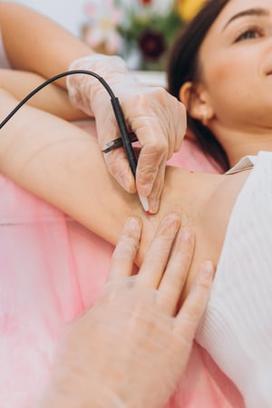 Images Naked Beauty Electrolysis