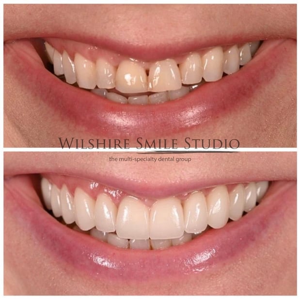 Images Wilshire Smile Studio - Los Angeles Dentist, Cosmetic and Emergency Dentistry